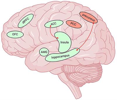 Medication overuse headache and substance use disorder: A comparison based on basic research and neuroimaging